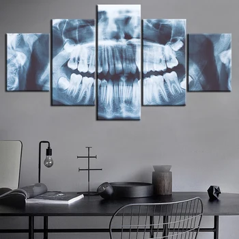 5 kos platno x-ray Zob zobna sliko Platno slika, slikarstvo soba dekor natisni plakat wall art