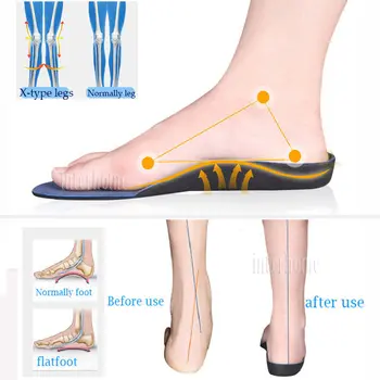 Ravno Stopala Vložek Podpora Narti za Preprečevanje Stoji Nestabilnost X-type noge Orthotics Čevlji Blazine Noge, nego Vstavite Ploščico Moški Ženske