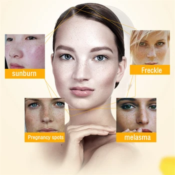 Dimollaure Močnih Zob Freckle Smetane + Alfa Arbutin Serum Odstranite Melasma Anti-aging Krema za Obraz za Nego Kože