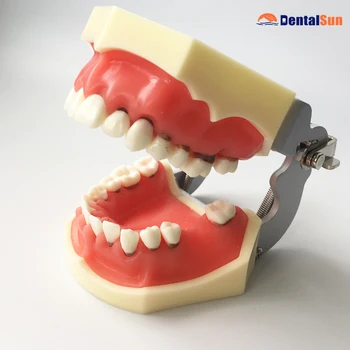 Zobni Periodontal Disease Model M4024/Zdravstveni Zob Medicinski Model